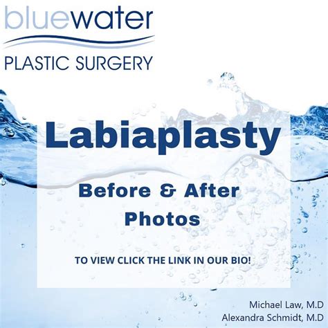 labia trim|Labiaplasty Overview: Cost, Recovery, Before & After .